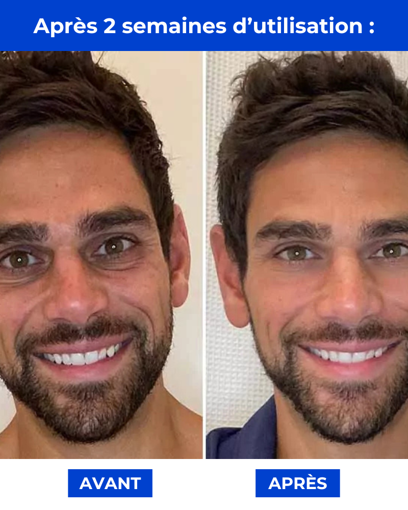 Manova - La Crème Anti-Âge Qui Lisse et Revitalise Votre Peau