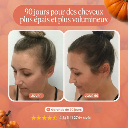 Follicure - Gélules à base d'huile de pépins de courge