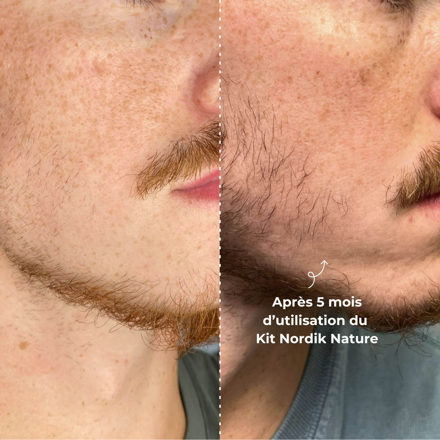 Le Kit Nordik Nature - Kit de la repousse de la barbe
