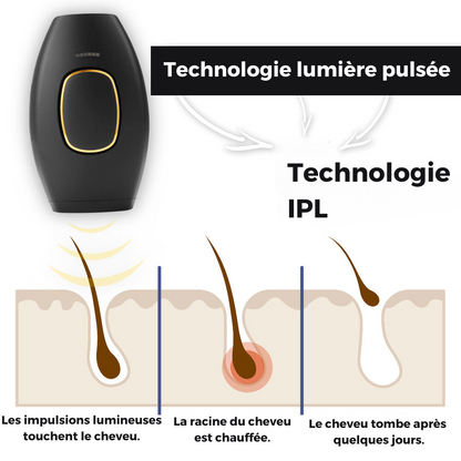 Épilateur IPL pour Hommes - Namido