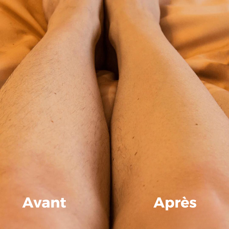 Épilateur Namido pour Hommes