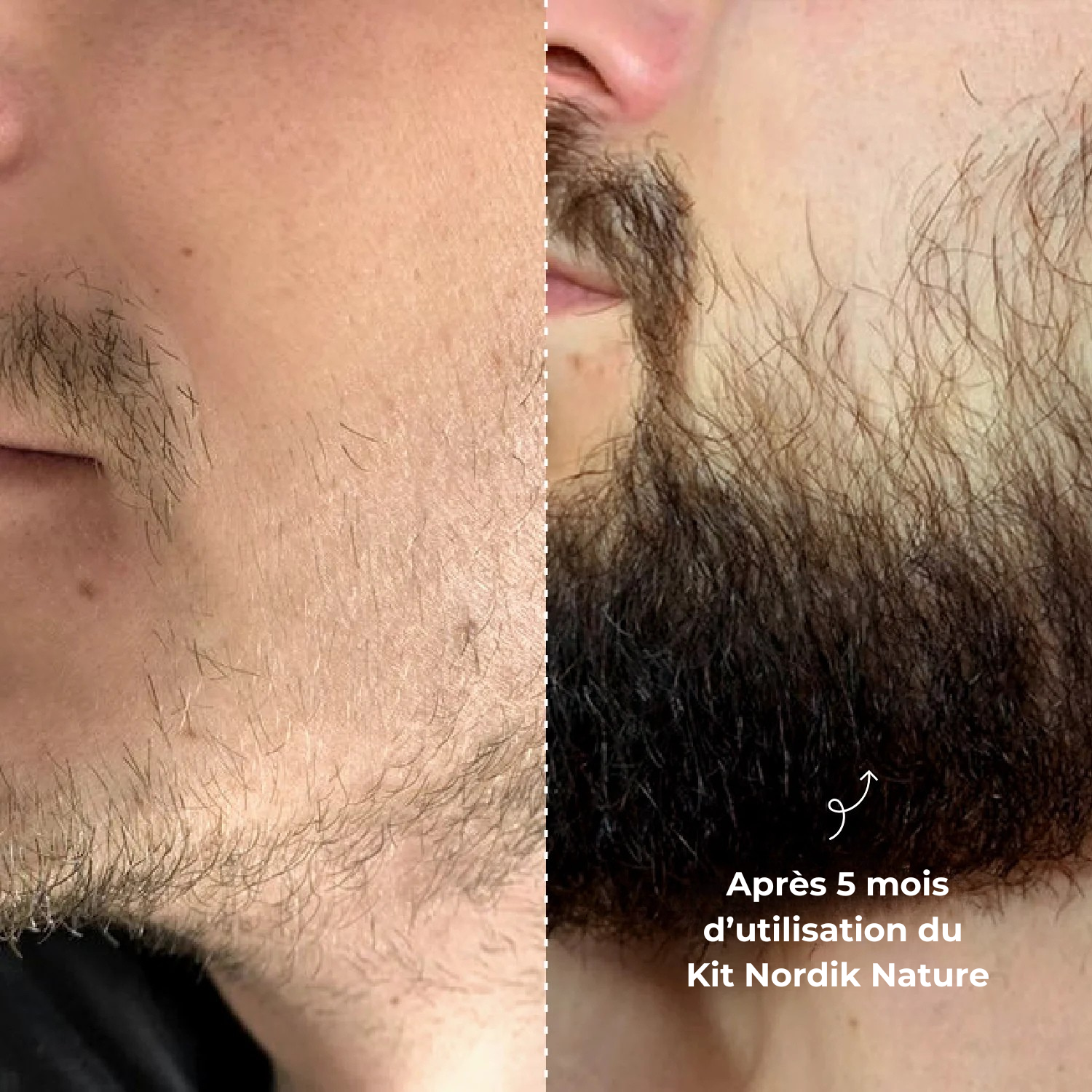 Le Kit Nordik Nature - Kit de la repousse de la barbe