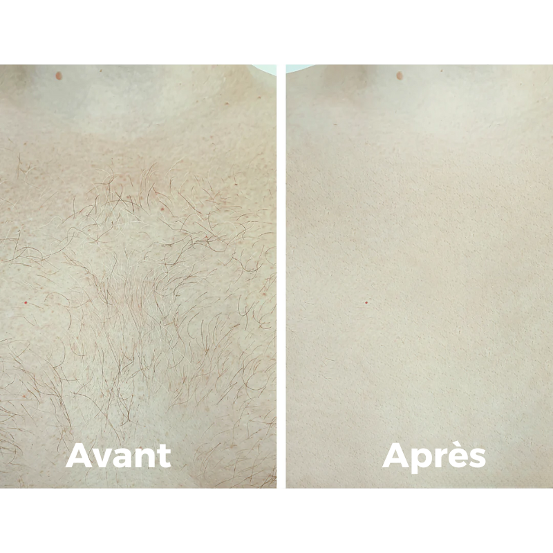 Épilateur Namido pour Hommes