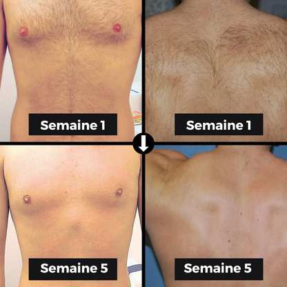 Épilateur IPL pour Hommes - Namido