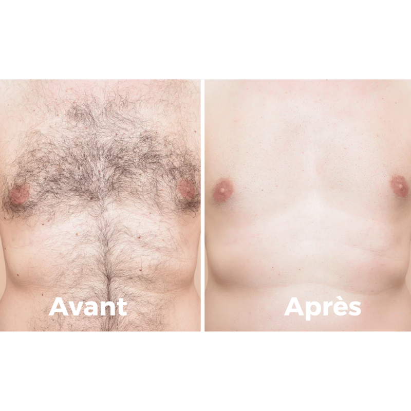 Épilateur Namido pour Hommes