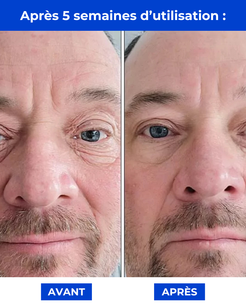 Manova - La Crème Anti-Âge Qui Lisse et Revitalise Votre Peau