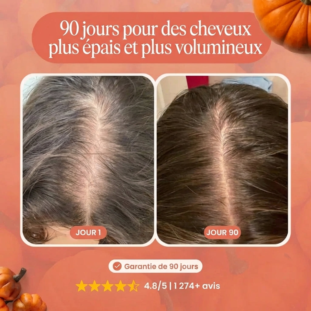 Follicure - Gélules à base d'huile de pépins de courge