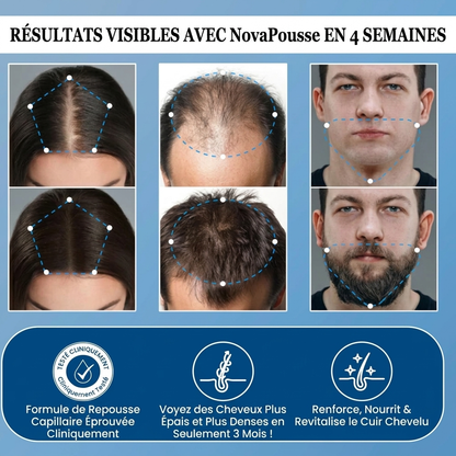 NovaPousse – Le sérum naturel pour des cheveux plus denses