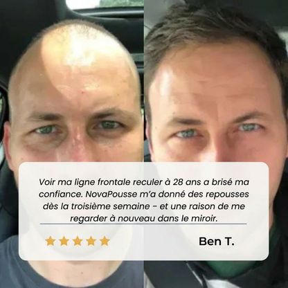 NovaPousse – Le sérum naturel pour des cheveux plus denses